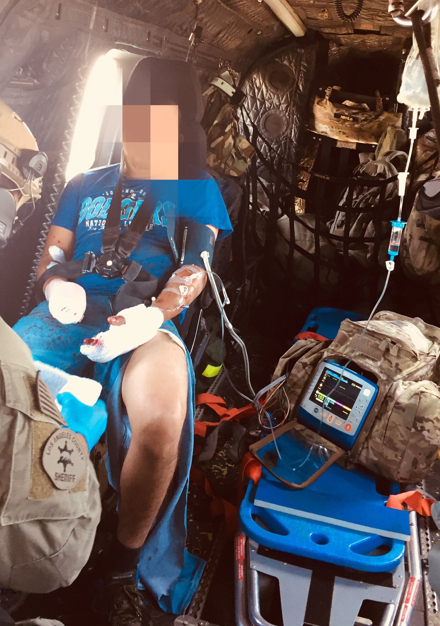 Los Angeles County sheriff's officials released this image of a man being airlifted for treatment of a fireworks injury on July 2, 2018.