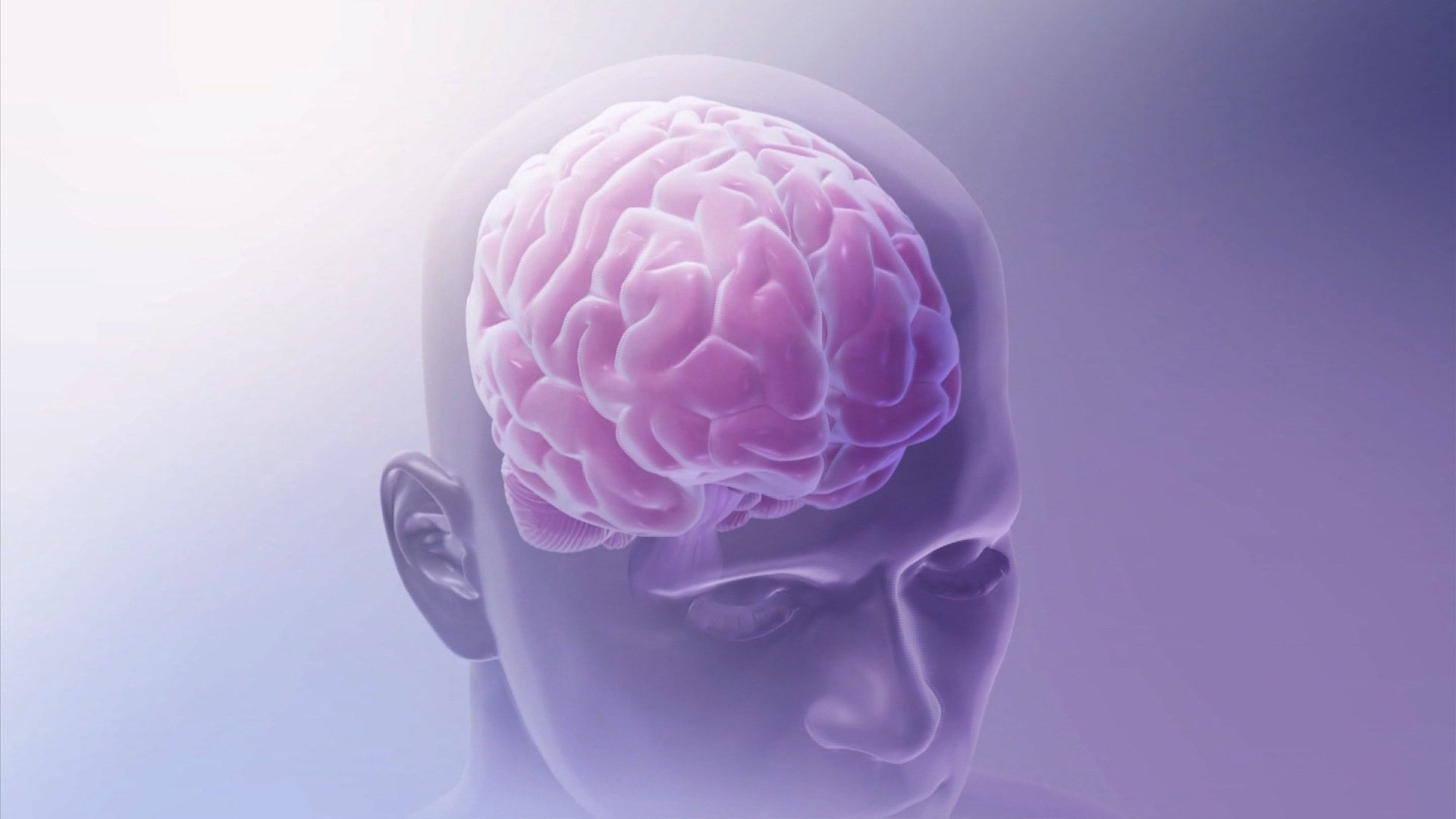 Researchers can now image the entire disease process from the start of the tangles (tau proteins that have collapsed and twisted) and plaques (clumps of amyloid proteins that build up in the space between nerve cells) that may unlock the secrets of Alzheimer's disease. (CNN)