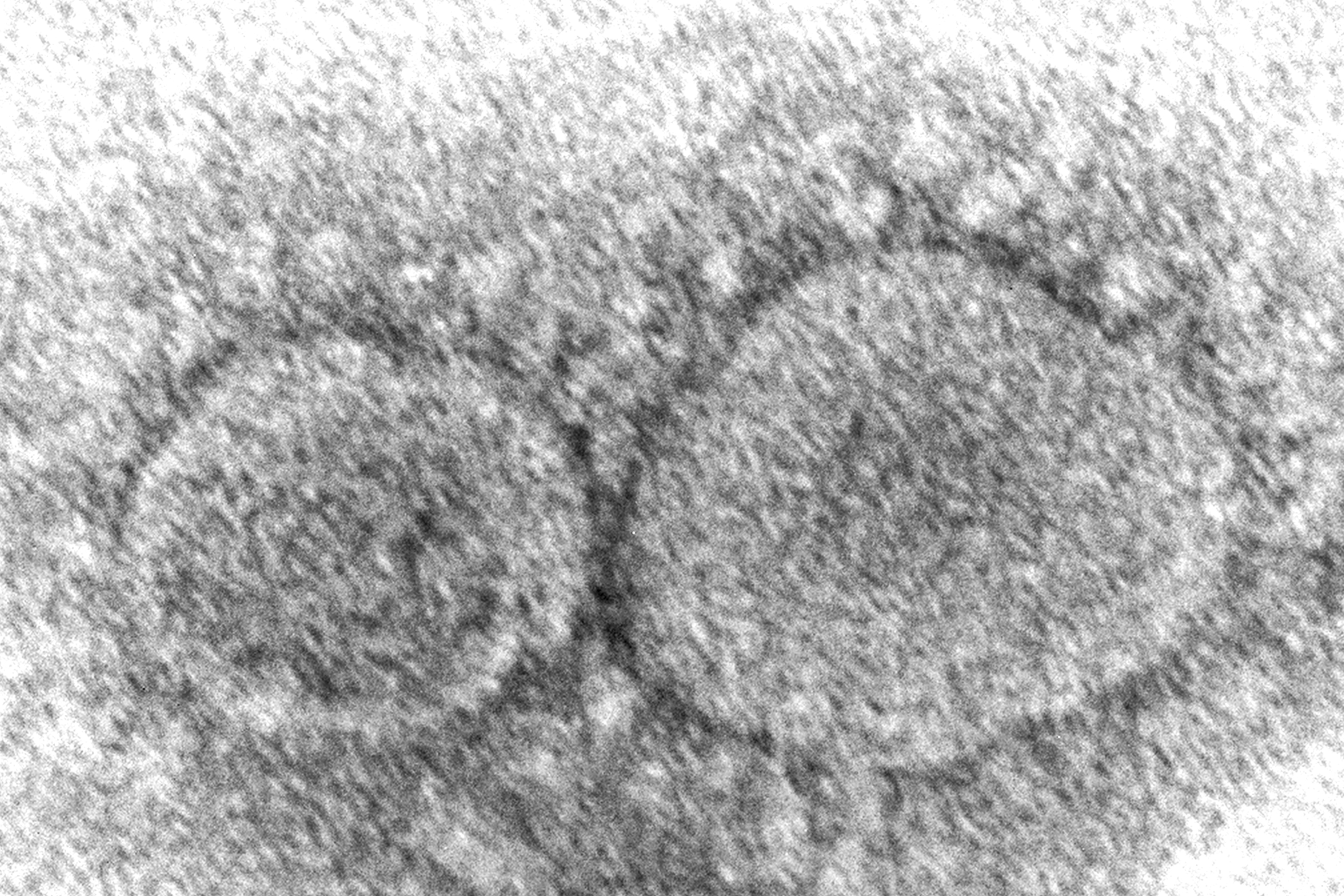 This 2020 electron microscope image made available by the Centers for Disease Control and Prevention shows SARS-CoV-2 virus particles which cause COVID-19. According to research released in 2021, evidence is mounting that having COVID-19 may not protect against getting infected again with some of the new variants. (Hannah A. Bullock, Azaibi Tamin/CDC via AP)