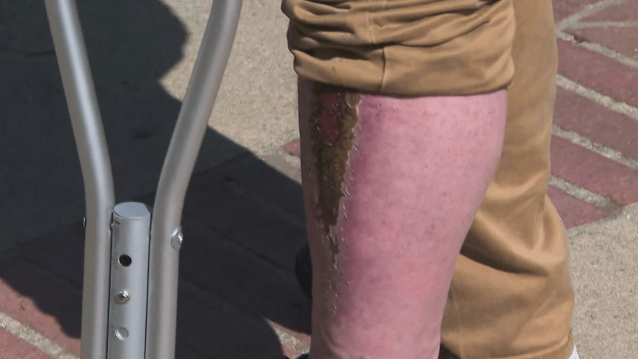 An injury is seen to a man following an altercation with security at UCLA on April 30, 2024.