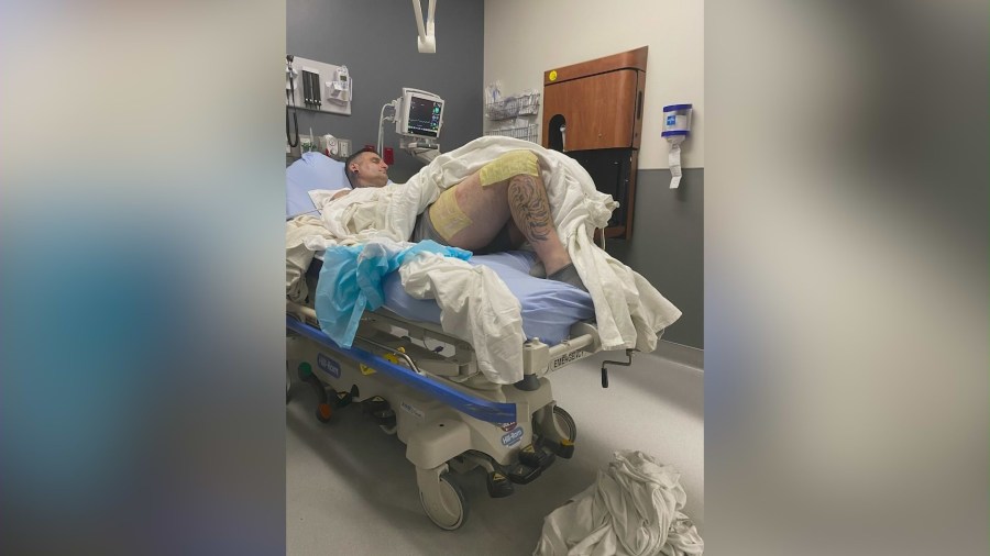Derek Strano was hospitalized after being ejected from a coffee cart during a police pursuit. (Derek Strano)