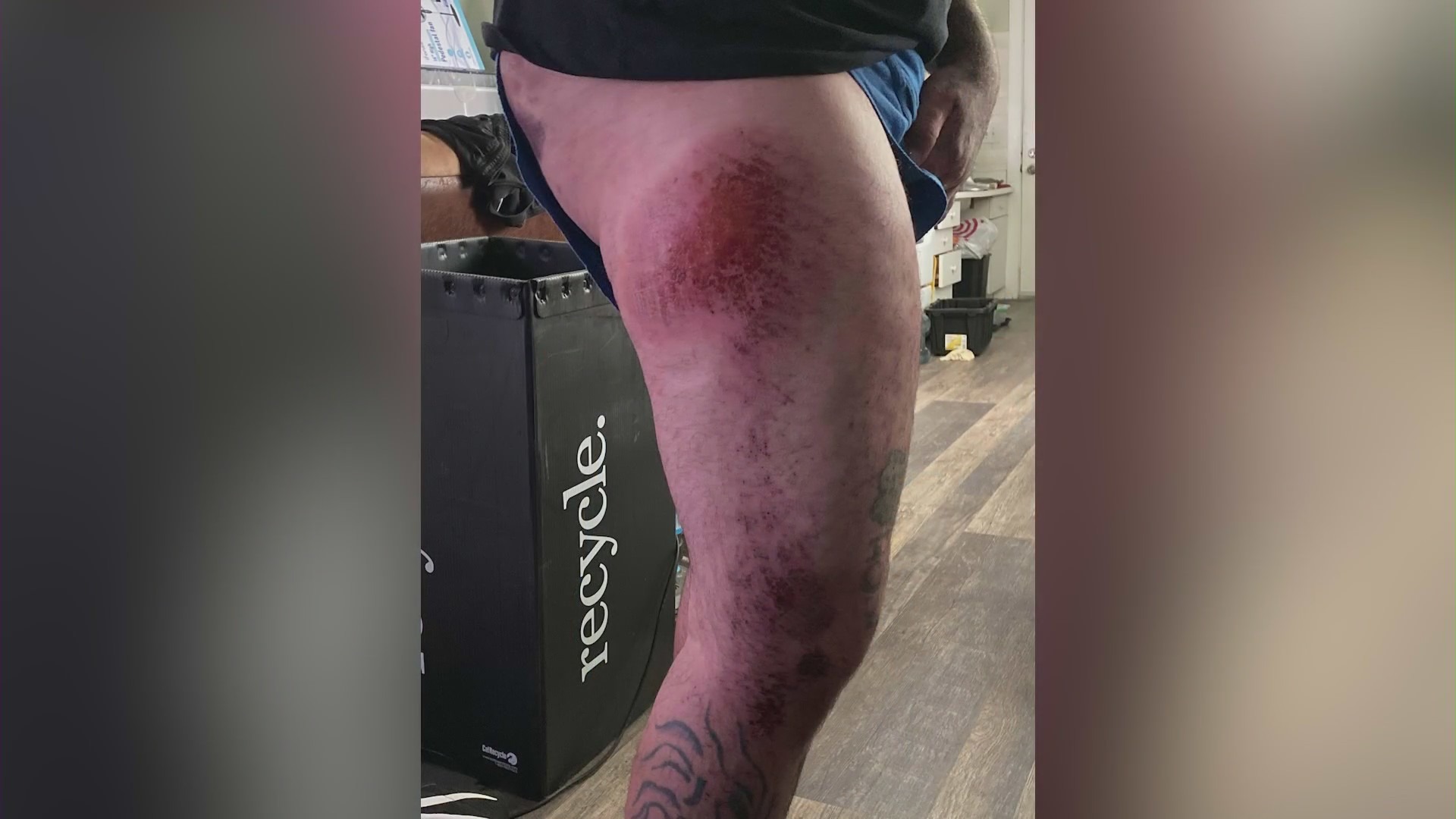 Derek Strano was hospitalized with serious injuries after being ejected from a coffee cart during a police pursuit. (Derek Strano)