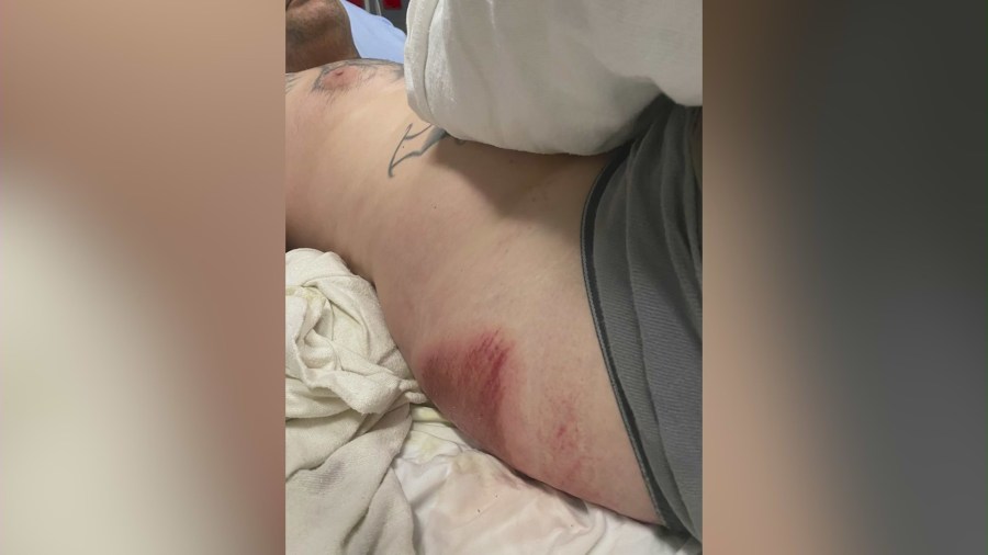 Derek Strano was hospitalized with serious injuries after being ejected from a coffee cart during a police pursuit. (Derek Strano)