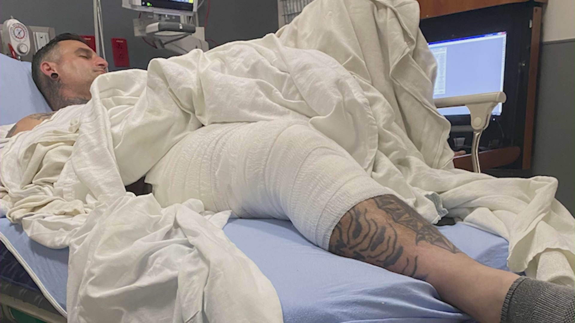 Derek Strano was hospitalized with serious injuries after being ejected from a coffee cart during a police pursuit. (Derek Strano)