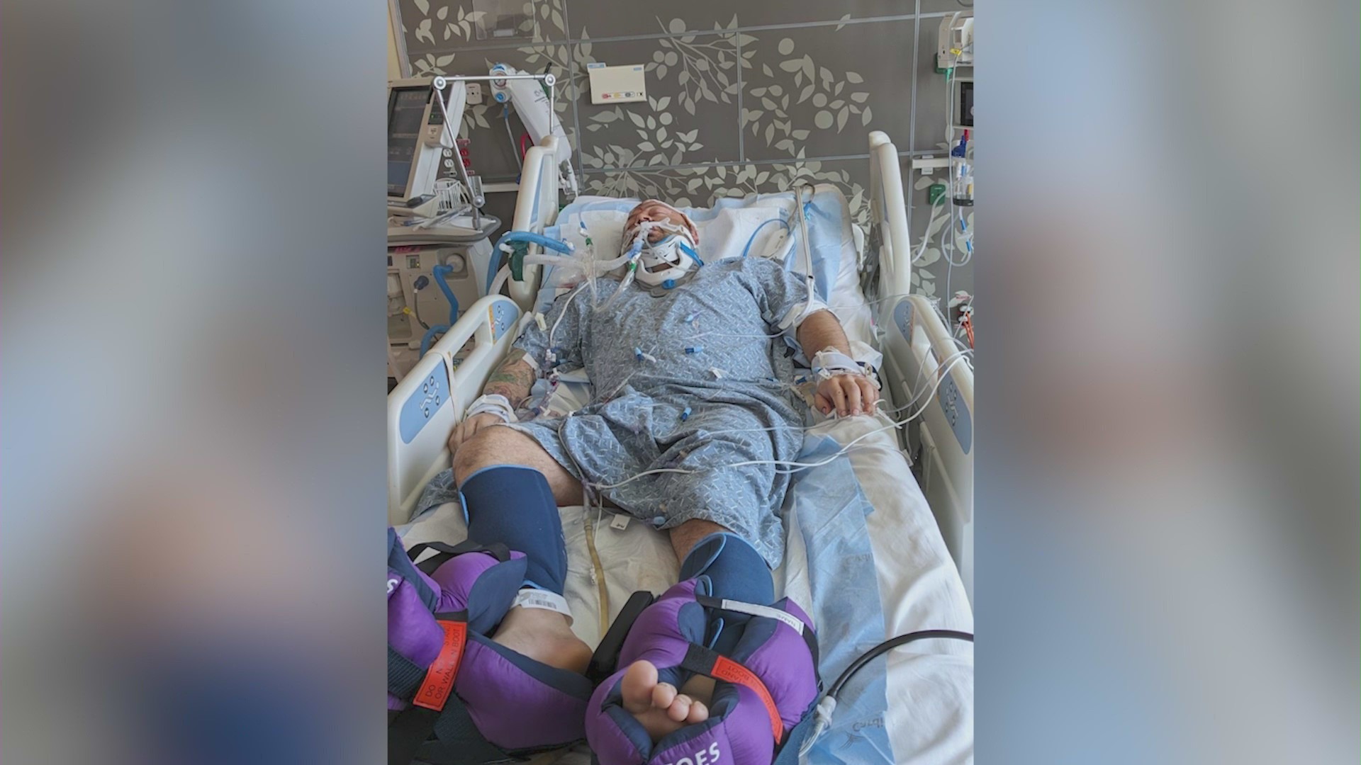 Michael Roque was hospitalized in the ICU after he was brutally beaten and stabbed in the face and head on July 22, 2024. (Roque Family)