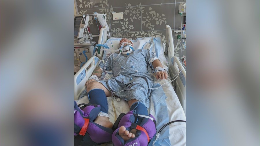 Michael Roque was hospitalized in the ICU after he was brutally beaten and stabbed in the face and head on July 22, 2024. (Roque Family)