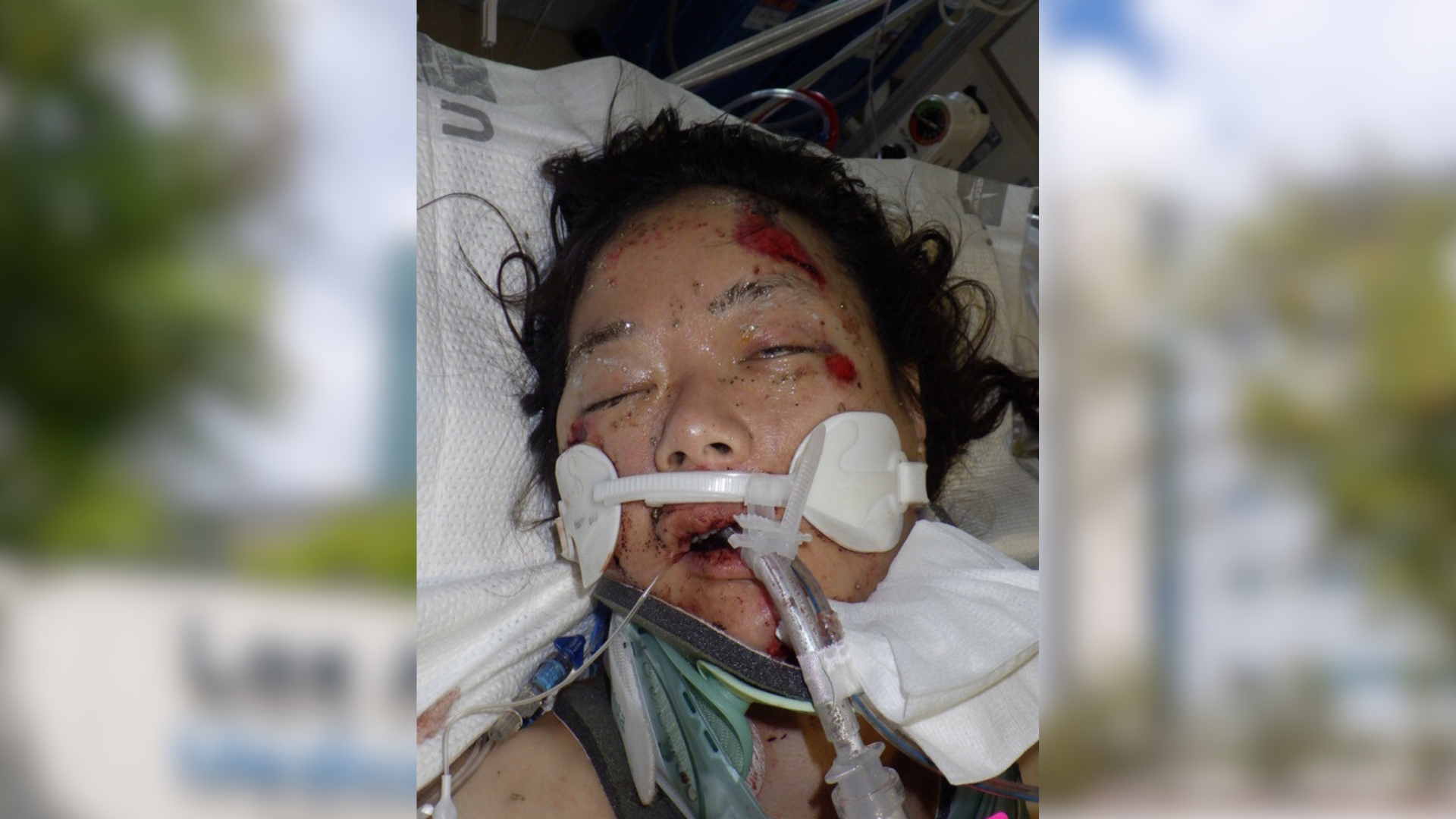 Hospital staff needs help identifying an injured female patient in her mid-30s who has been hospitalized since August 16, 2024. (Los Angeles General Medical Center)