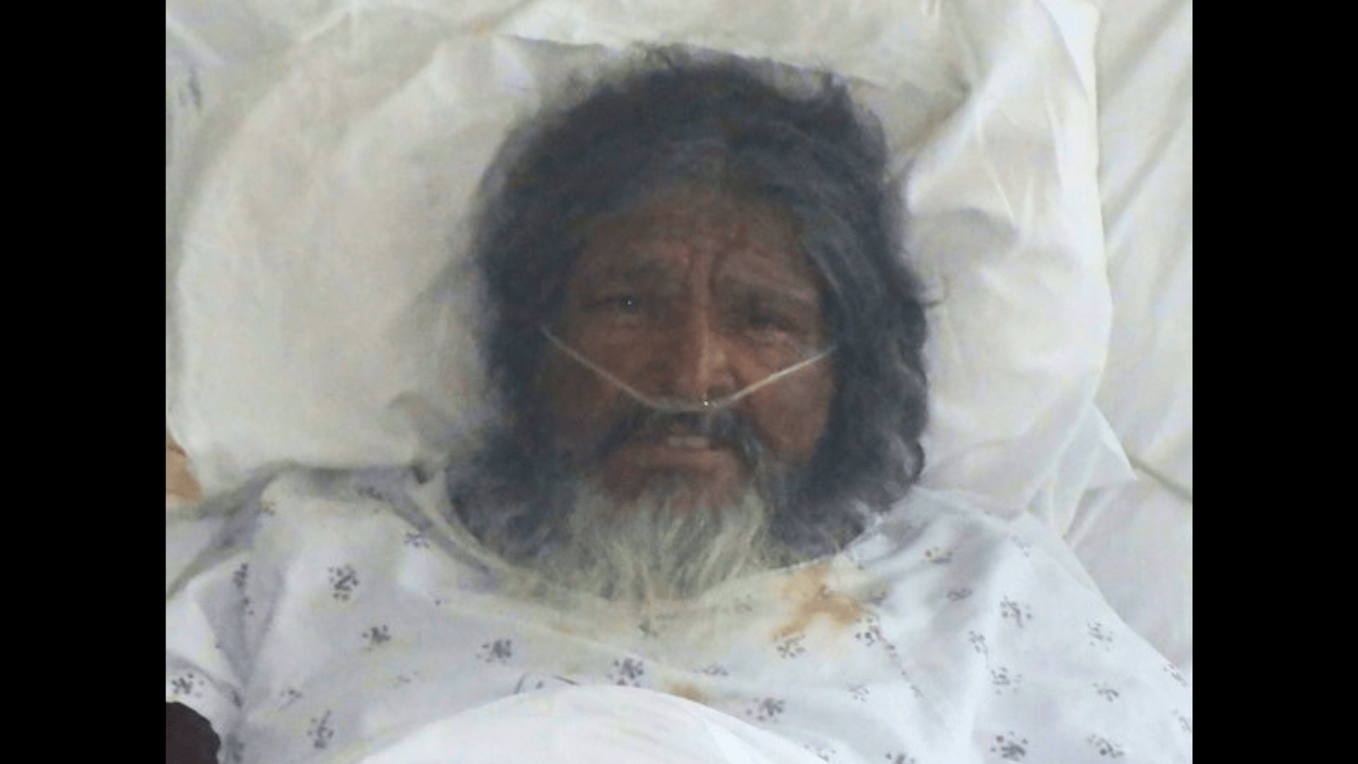 A male patient who was found injured near a park in Lincoln Heights has been hospitalized since Sept. 6., 2024. (Los Angeles General Medical Center)