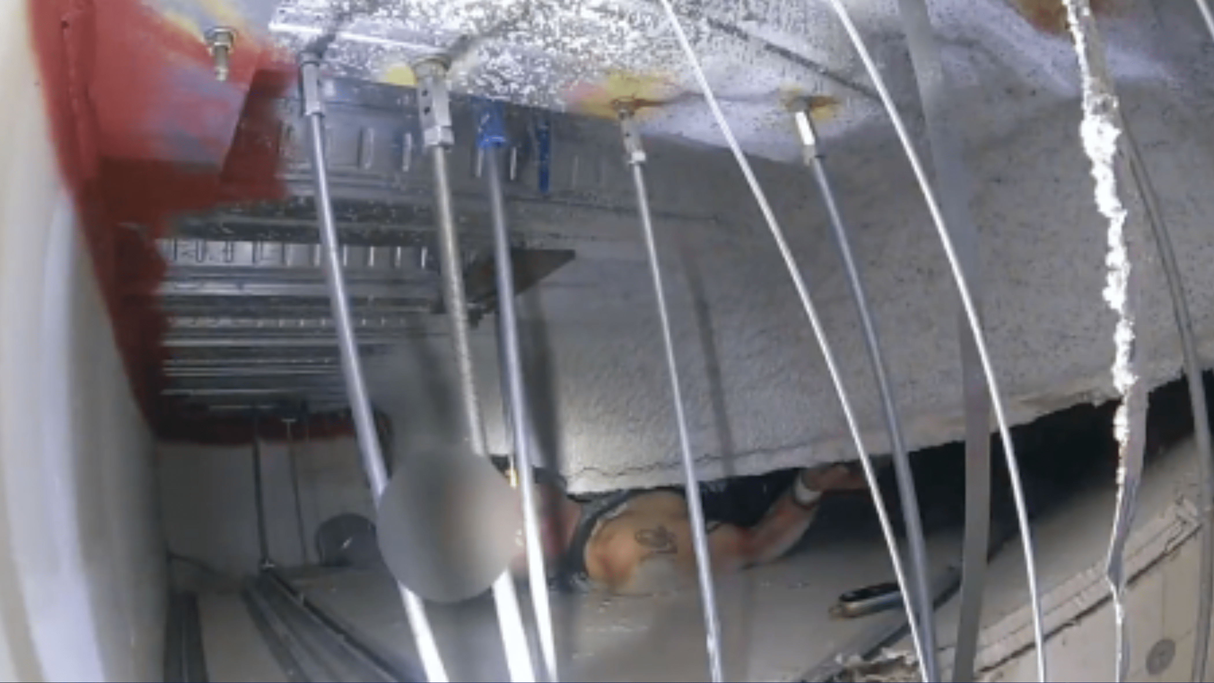 Man stuck in hospital ceiling