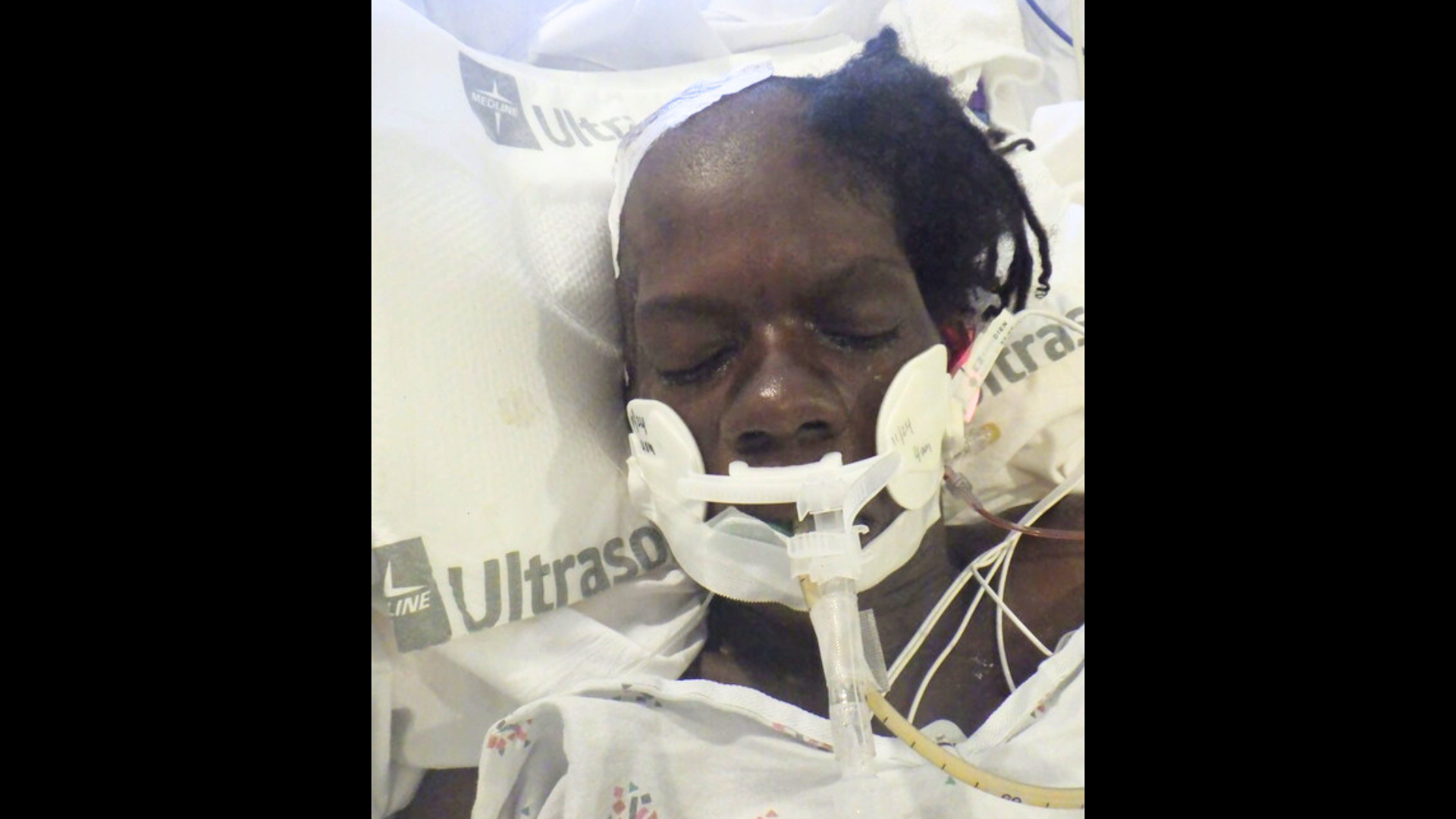 A female patient who was found injured on the ground in downtown Los Angeles has been hospitalized since Nov. 19, 2024. (Los Angeles General Medical Center)