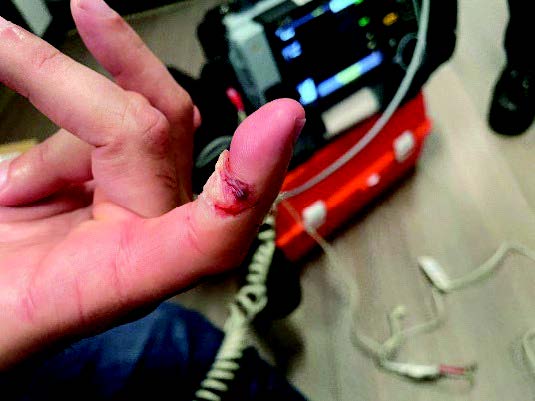 An Orange County man is accused of attempting to bite off an ICE officers finger during an arrest in downtown Los Angeles on Feb. 25, 2025. (United States Department of Justice)