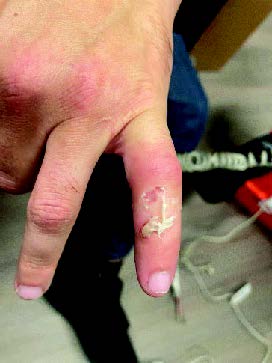 An Orange County man is accused of attempting to bite off an ICE officers finger during an arrest in downtown Los Angeles on Feb. 25, 2025. (United States Department of Justice)