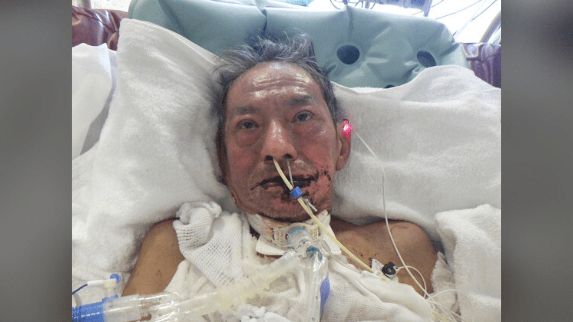 A hospital needs help identifying a male patient found injured in San Gabriel on Jan. 19, 2025. (Los Angeles General Medical Center)
