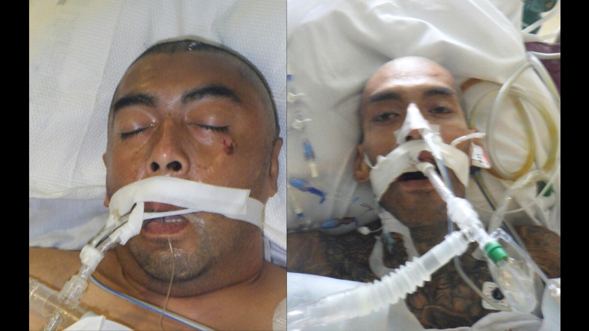 A hospital needs help identifying two patients who were found injured in Los Angeles County. (Los Angeles General Medical Center)
