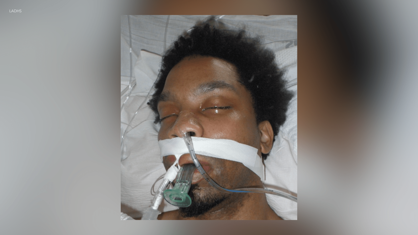 Los Angeles General Medical Center is seeking the identity of this patient who has been receiving care since March 23, 2025. (Los Angeles County Department of Health Services)