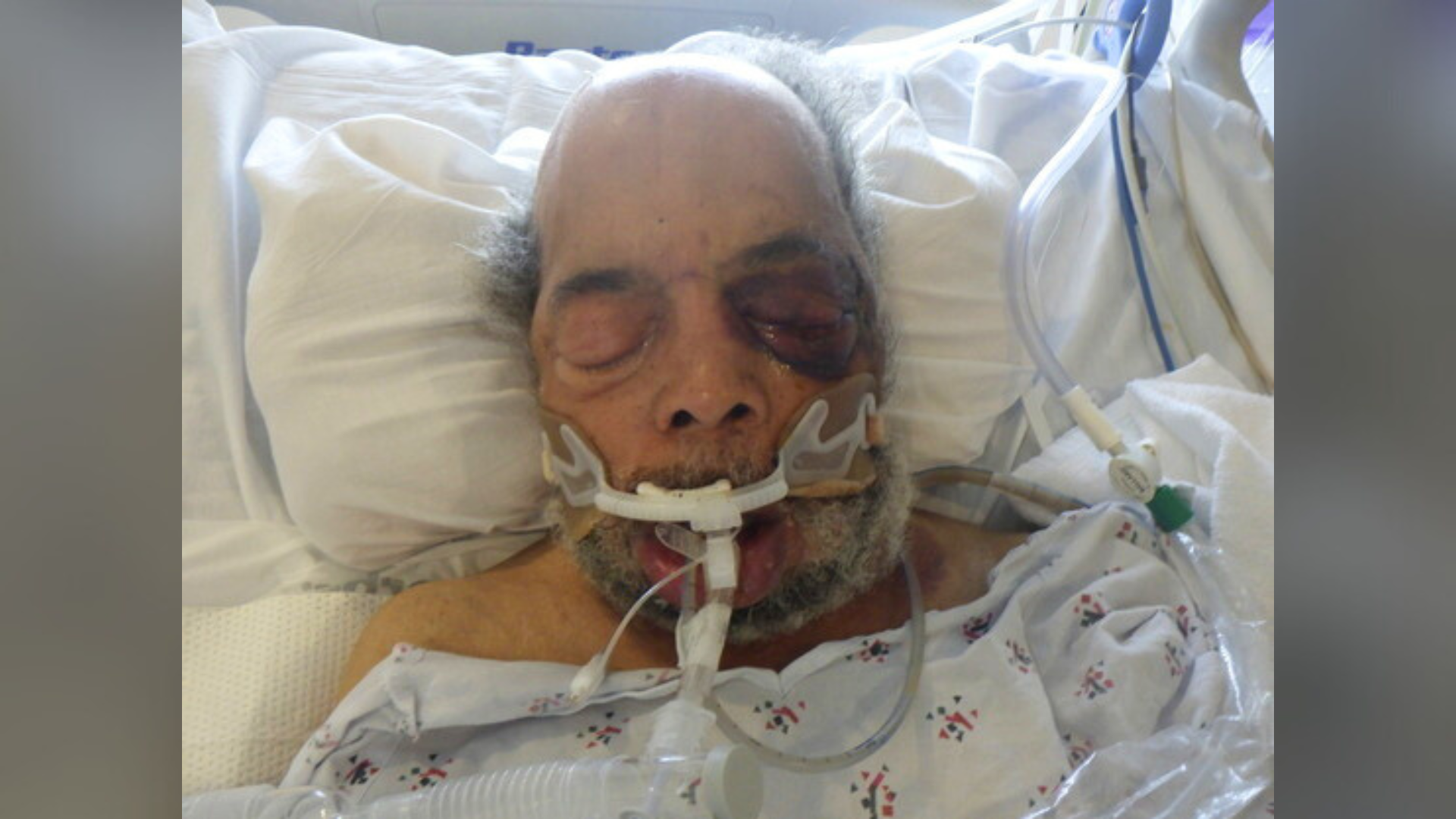 Hospital workers need help identifying a male patient found injured in Monterey Park on Feb. 20, 2025. (Los Angeles General Medical Center)