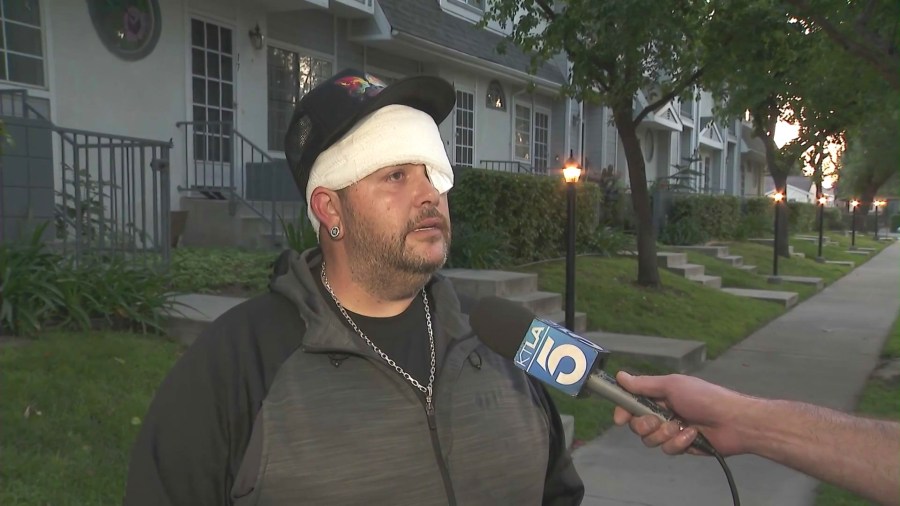 Chris Bailey, known on TikTok as @kloverkinglosangeles, was serving food to homeless residents in downtown Los Angeles when he was violently beaten by a suspect who remains at large on April 22, 2025. (KTLA)