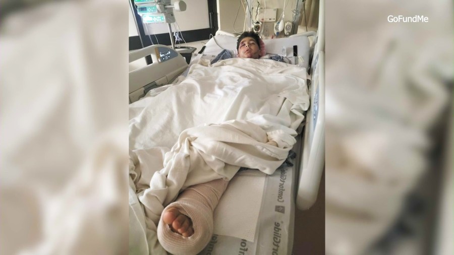Emiliano Flores, 11, was hospitalized after he collided with a vehicle while riding an electric scooter in a Victorville neighborhood on March 29, 2025. (GoFundMe)