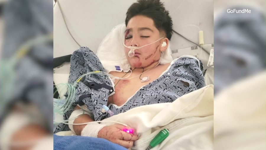 Emiliano Flores, 11, was hospitalized after he collided with a vehicle while riding an electric scooter in a Victorville neighborhood on March 29, 2025. (GoFundMe)