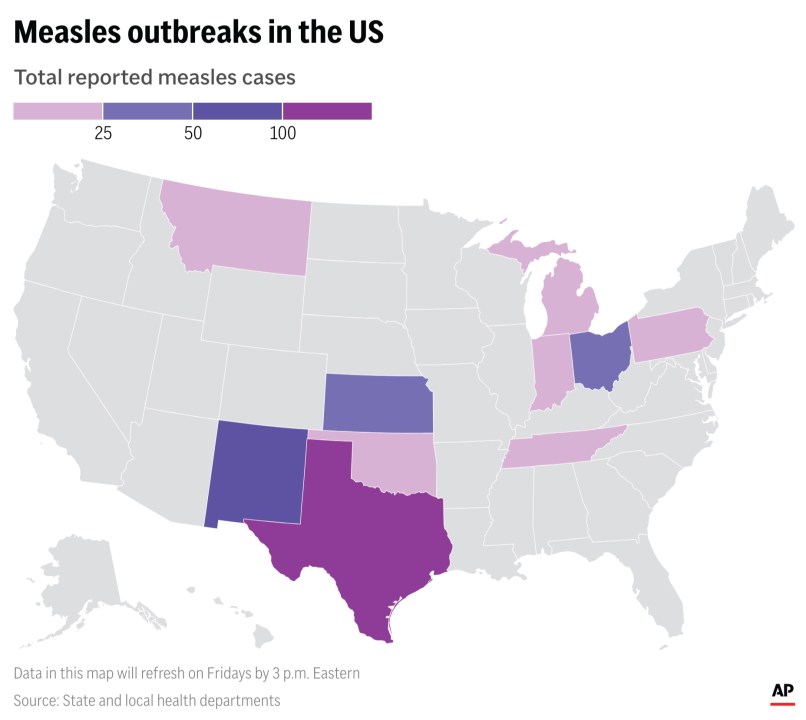 The map above shows states that have been affected by recent measles outbreaks in the U.S. (AP Graphic)