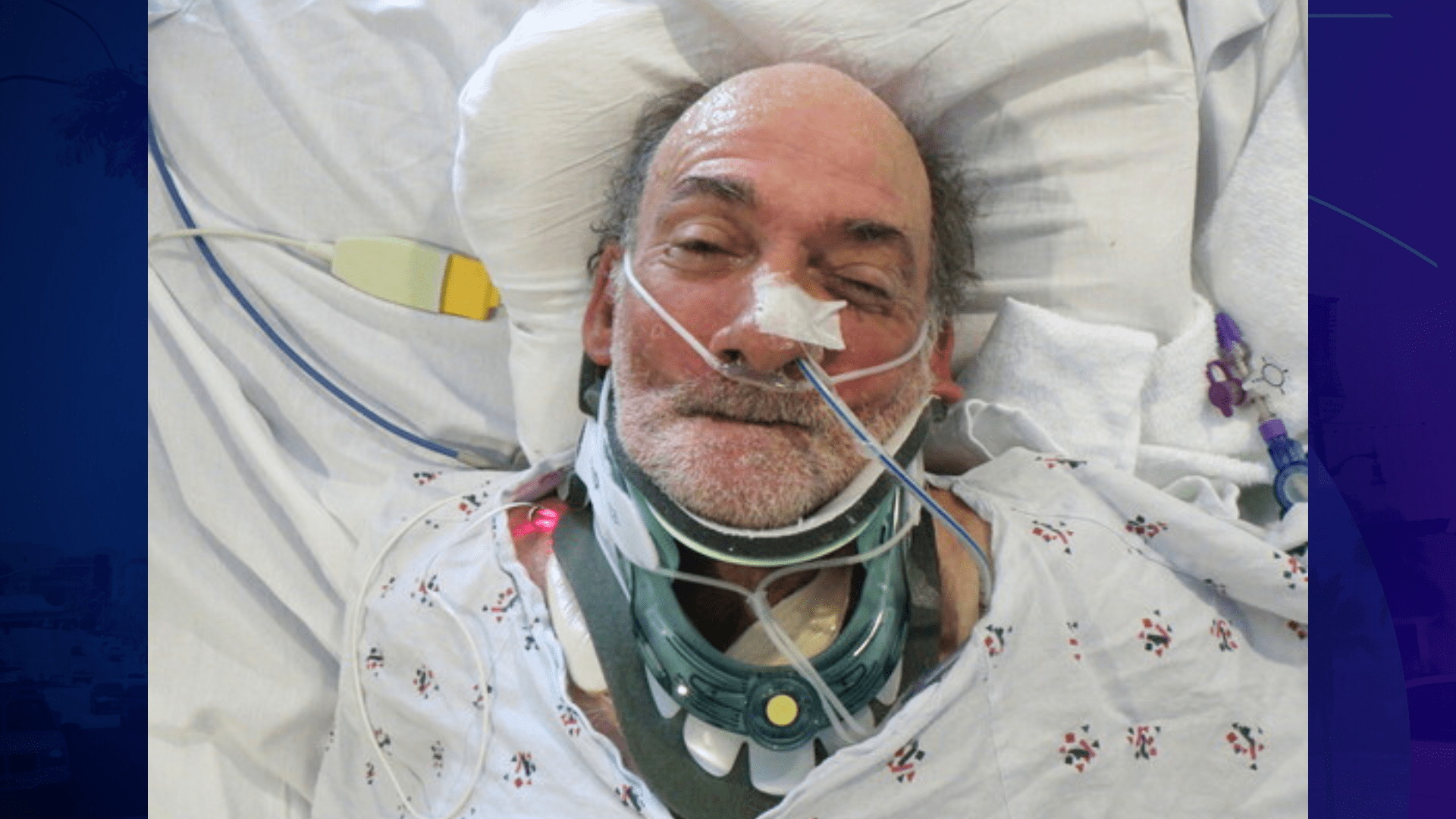 A male patient around 63 years old who was found injured near 7th and Flower Streets in downtown L.A. on May 3, 2025. (Los Angeles General Medical Center)