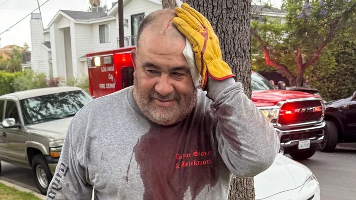 Rodolfo Roman was brutally attacked and received multiple staples to his head and was left with a broken arm following the brutal assault. (GoFundMe)