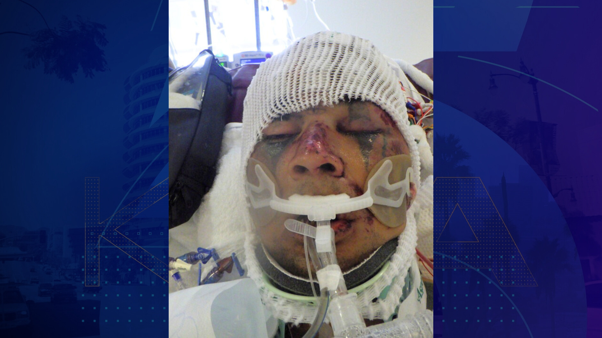 A male patient around 30 years old was found injured near Agatha and Crocker Streets in downtown L.A. on June 17, 2025. (Los Angeles General Medical Center)