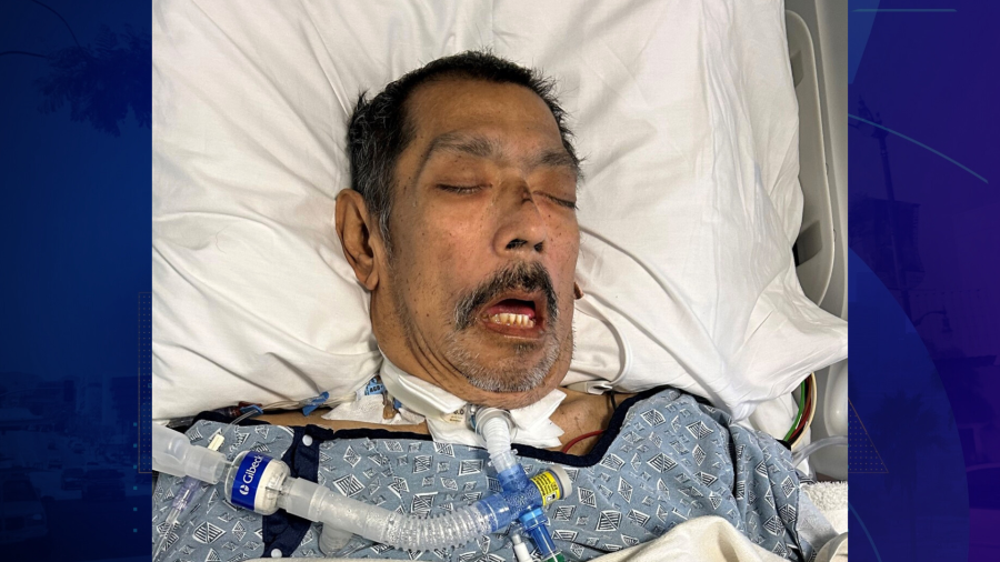 The second patient is a man around 60 years old. His first name may be Miguel. He was brought to the hospital from a senior living facility in Bell Gardens. (St. Francis Medical Center)