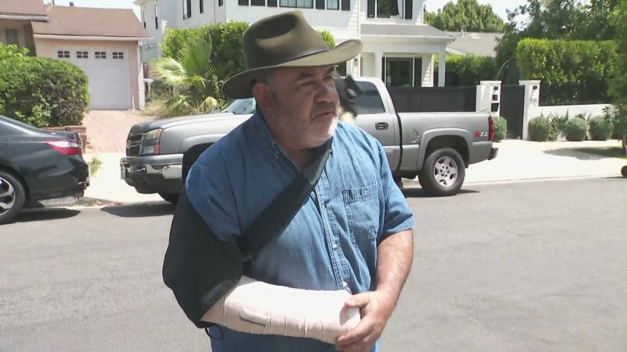 Rodolfo Roman received multiple staples to his head and was left with a broken arm following the brutal assault. (KTLA)