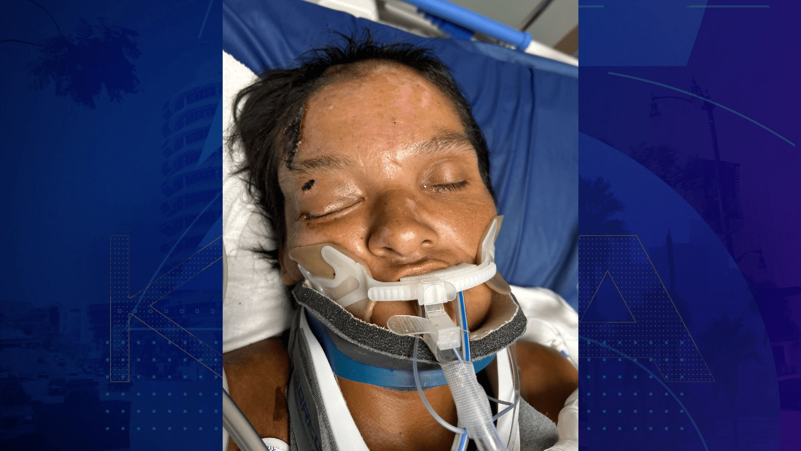 A female patient around 42 years old was found injured in Riverside on Aug. 11, 2025. (Riverside Community Hospital)