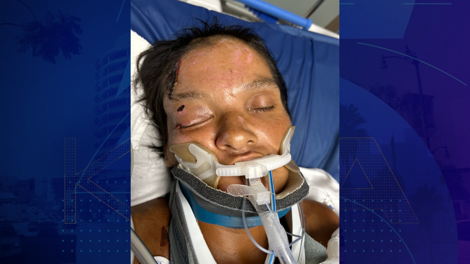 A female patient around 42 years old was found injured in Riverside on Aug. 11, 2025. (Riverside Community Hospital)