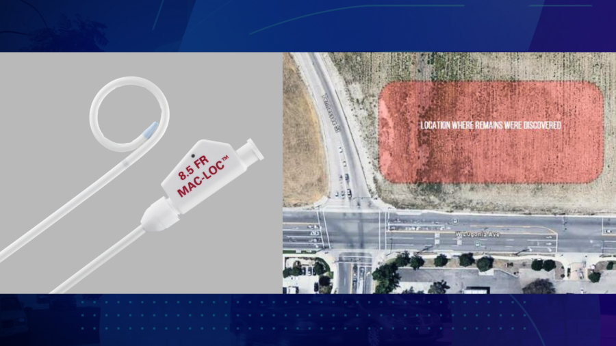 Detectives said the woman also used a catheter, (replica shown) which was discovered with her remains. (Redlands Police Department)