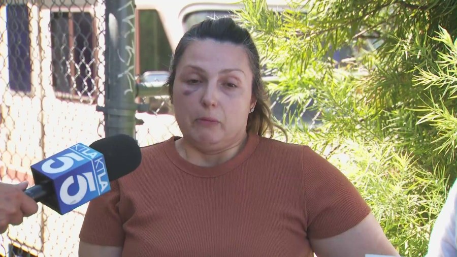 Rebecca Haro speaks to KTLA on Aug. 15, 2025, recalling the moment she was attacked before her 7-month-old baby was kidnapped in Yucaipa. (KTLA)