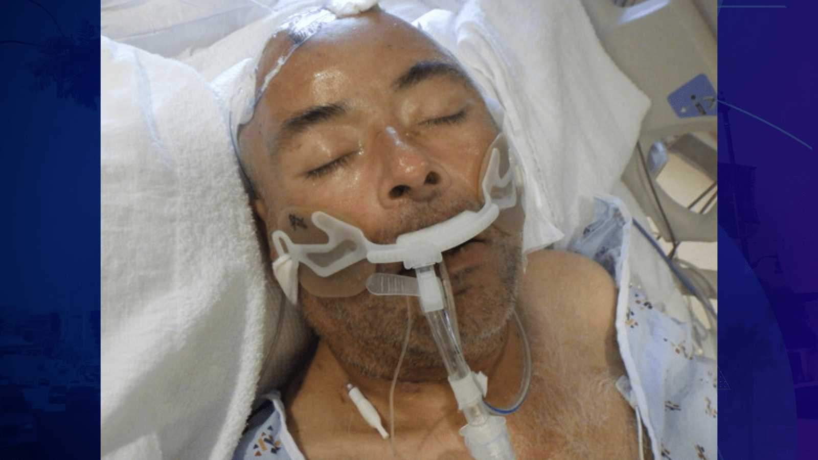 A male patient around 45 years old was found injured at Union Station in downtown Los Angeles on Aug. 23, 2025. (Los Angeles General Medical Center)