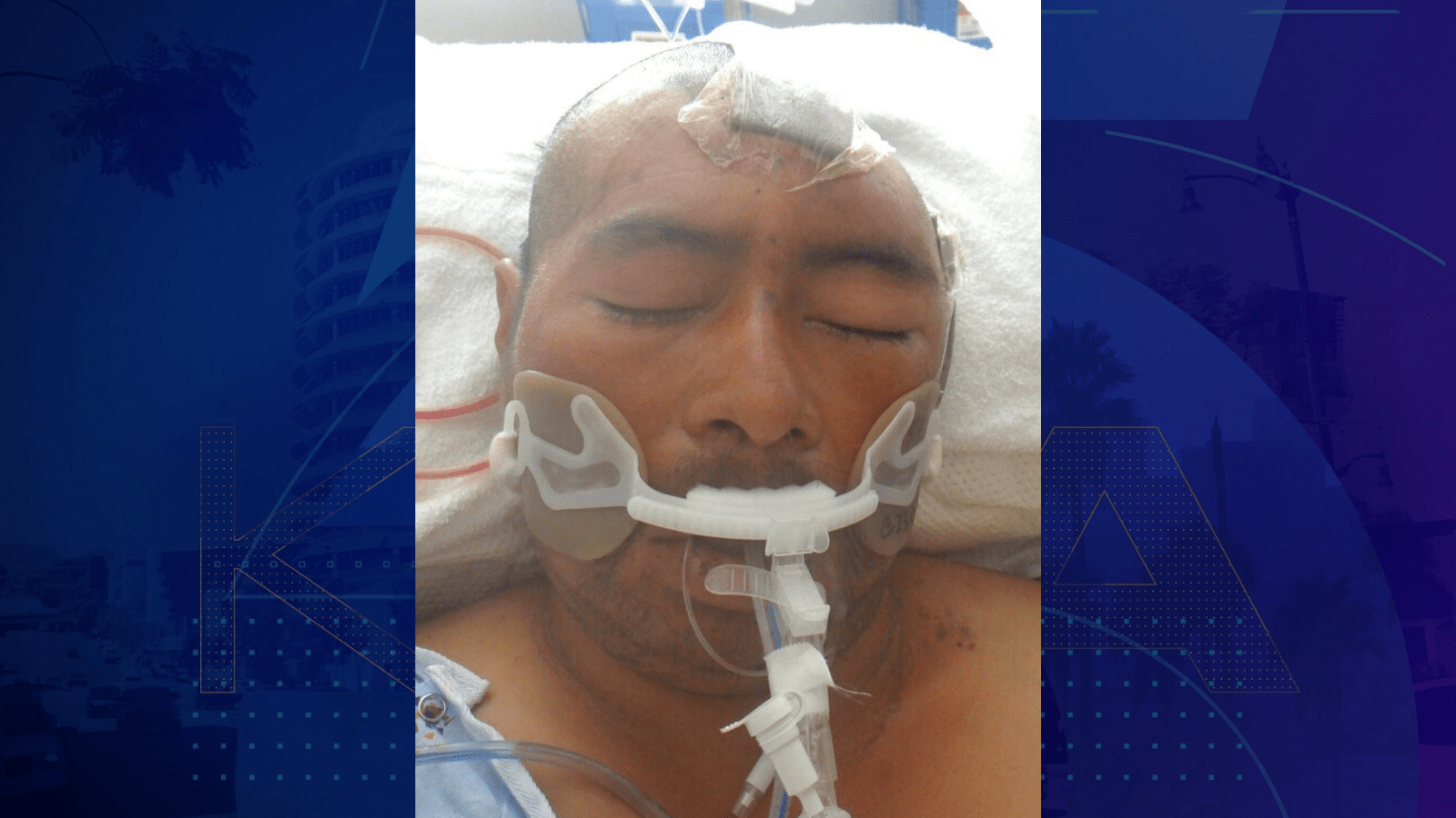 A male patient around 40 years old was found injured in South Los Angeles on Sept. 17, 2025. (Los Angeles General Medical Center)