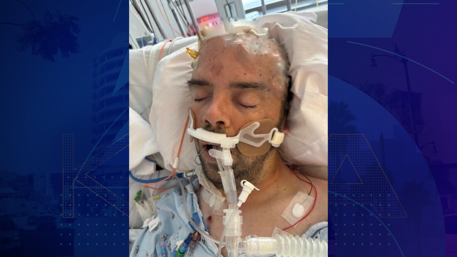 A male patient in his mid-to-late 30s was found injured in Malibu on Sept. 26, 2025. (Ronald Reagan UCLA Medical Center)