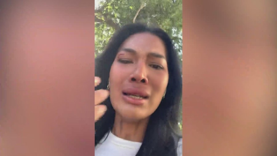 Hollywood model attacked