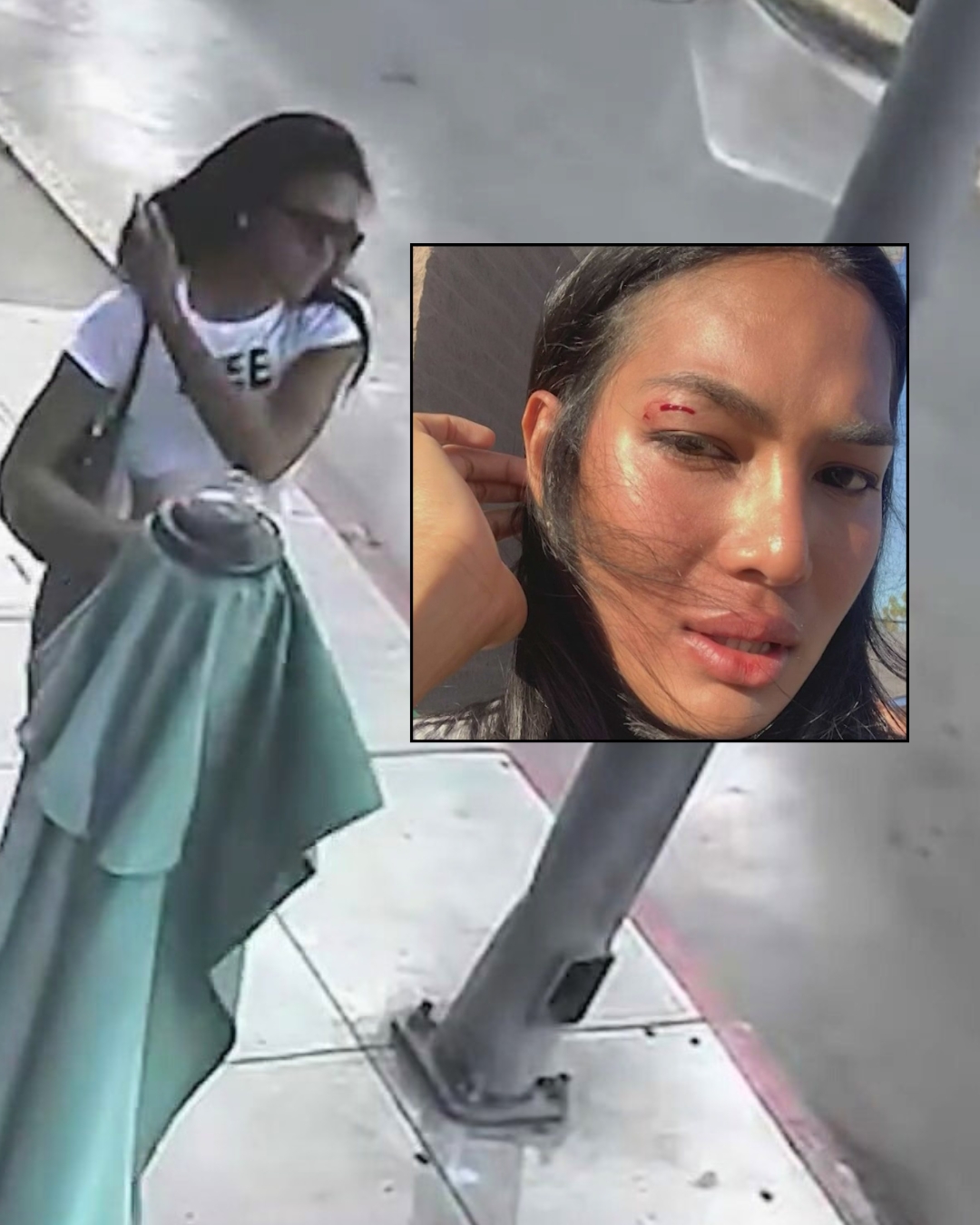 Hollywood model attacked